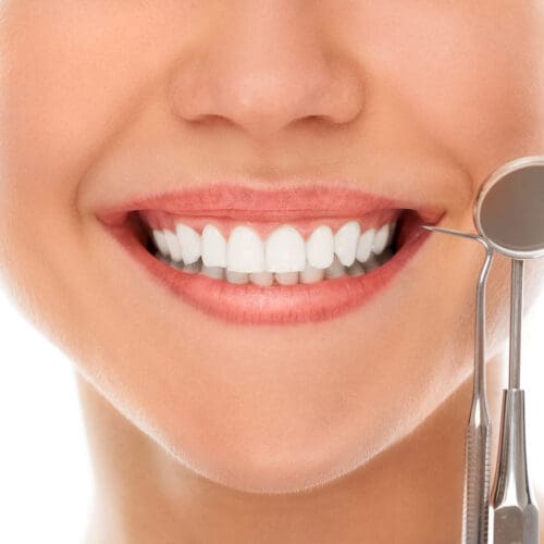 A woman is smiling while being at the dentist (Hollywood smile / veneers)