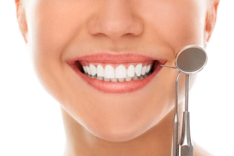 A woman is smiling while being at the dentist (Hollywood smile / veneers)