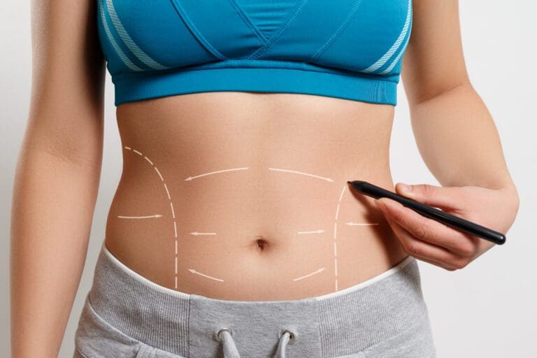 a woman shows a dotted line on her body liposuction zone. on white background