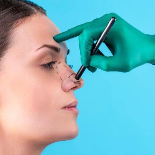 Rhinoplasty Nose Surgery