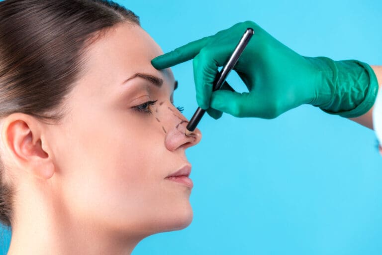 Nose-Surgery (Rhinoplasty)