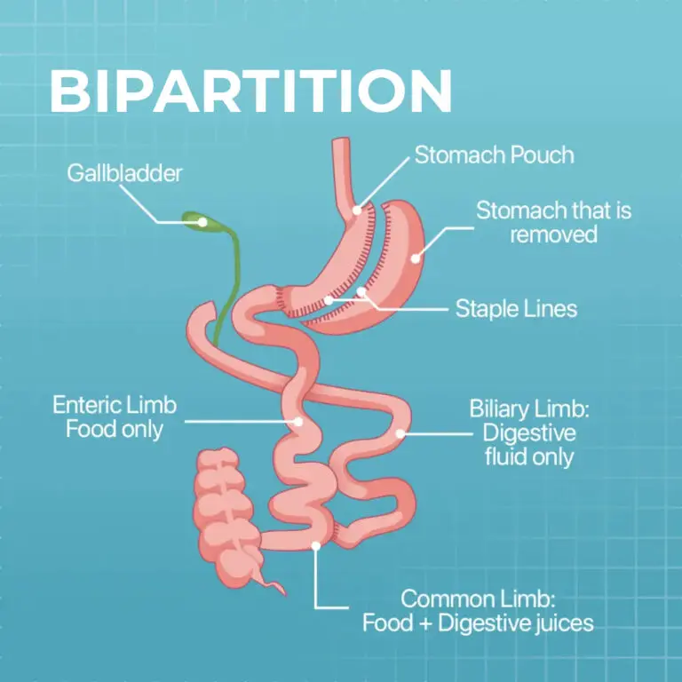 Transit Bipartition Weight Loss